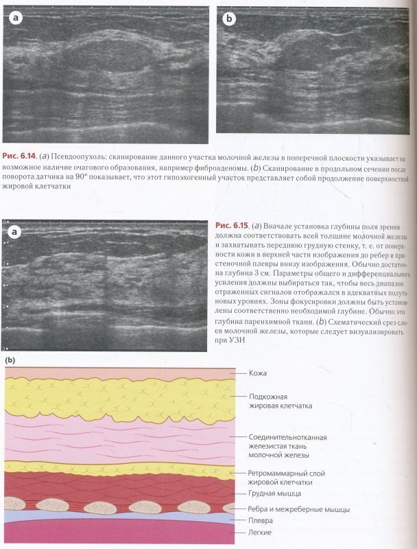 Схема узи молочных желез