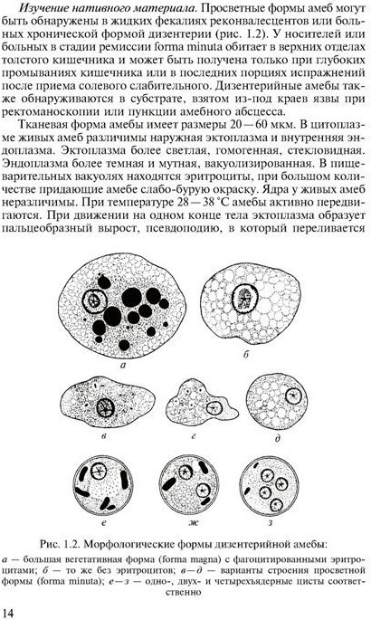 Форма амебы. Большая вегетативная форма дизентерийной амёбы. Форма Magna дизентерийной амебы. Крупная вегетативная форма (эритрофаг) амебы дизентерийной. Малая вегетативная форма дизентерийной амебы.