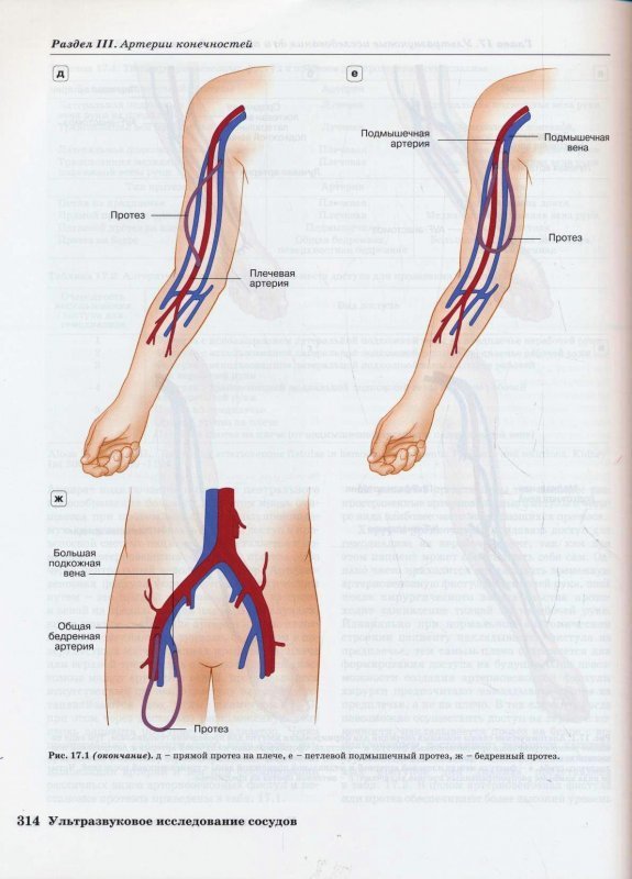 Протокол узи артерий верхних конечностей образец