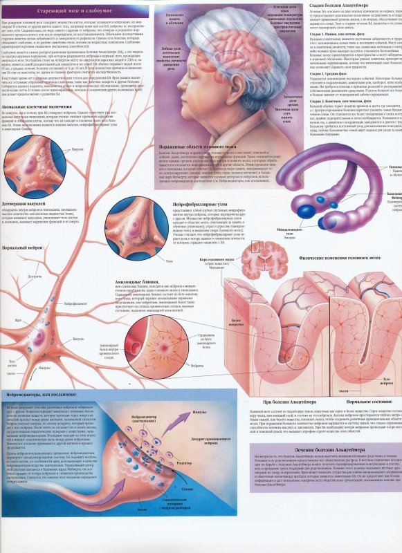 Упражнения от альцгеймера картинки